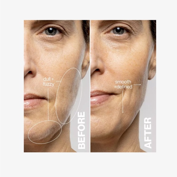 NIB new in box Dermaflash Luxe+ Sonic Dermaplaning Peach Fuzz Removal in Blush - Picture 4 of 9